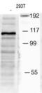 Mindbomb E3 Ubiquitin Protein Ligase 1 antibody, PA5-12069, Invitrogen Antibodies, Western Blot image 