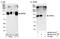 Protein Phosphatase 6 Regulatory Subunit 2 antibody, NB100-41414, Novus Biologicals, Western Blot image 