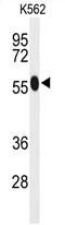 Acyl-CoA Synthetase Medium Chain Family Member 1 antibody, AP50063PU-N, Origene, Western Blot image 