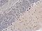 Pleiotropic Regulator 1 antibody, GTX106333, GeneTex, Immunohistochemistry paraffin image 