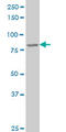 Deleted In Azoospermia 1 antibody, LS-B4311, Lifespan Biosciences, Western Blot image 