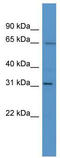 Homeobox C12 antibody, TA330642, Origene, Western Blot image 