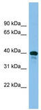 TSC22 Domain Family Member 4 antibody, TA329927, Origene, Western Blot image 