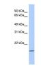 C-Type Lectin Like 1 antibody, NBP1-54968, Novus Biologicals, Western Blot image 