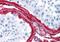 Collagen Type III Alpha 1 Chain antibody, orb86843, Biorbyt, Immunohistochemistry paraffin image 