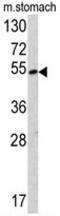 Lysine Methyltransferase 5C antibody, AP17772PU-N, Origene, Western Blot image 