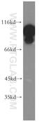 Eukaryotic Translation Elongation Factor 2 antibody, 20107-1-AP, Proteintech Group, Western Blot image 