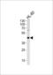Adenosine Deaminase antibody, LS-C156031, Lifespan Biosciences, Western Blot image 