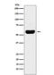 Amylase Alpha 1C (Salivary) antibody, M12967, Boster Biological Technology, Western Blot image 