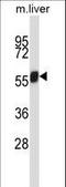 NIMA Related Kinase 3 antibody, LS-C164495, Lifespan Biosciences, Western Blot image 