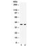 Galectin 4 antibody, R32387, NSJ Bioreagents, Western Blot image 