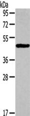 Interleukin 3 Receptor Subunit Alpha antibody, CSB-PA925610, Cusabio, Western Blot image 