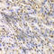 Dystrobrevin Binding Protein 1 antibody, A1632, ABclonal Technology, Immunohistochemistry paraffin image 