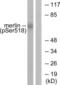 Neurofibromin 2 antibody, LS-C117415, Lifespan Biosciences, Western Blot image 