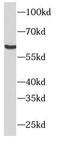 NR5A2 antibody, FNab05848, FineTest, Western Blot image 