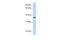 Transmembrane Protein 200B antibody, PA5-69311, Invitrogen Antibodies, Western Blot image 