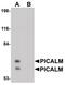 Phosphatidylinositol Binding Clathrin Assembly Protein antibody, PA5-20871, Invitrogen Antibodies, Western Blot image 