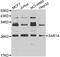 Secretion Associated Ras Related GTPase 1A antibody, STJ29612, St John