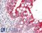 Insulin Like Growth Factor Binding Protein 3 antibody, LS-B12492, Lifespan Biosciences, Immunohistochemistry paraffin image 