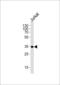 Low affinity immunoglobulin gamma Fc region receptor II-a antibody, 63-704, ProSci, Western Blot image 