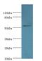 Epoxide Hydrolase 1 antibody, LS-C369587, Lifespan Biosciences, Western Blot image 