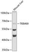 Tripartite Motif Containing 69 antibody, 19-938, ProSci, Western Blot image 