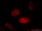 ArfGAP With FG Repeats 2 antibody, 11919-1-AP, Proteintech Group, Immunofluorescence image 
