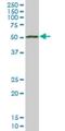 Transcriptional adapter 2-beta antibody, H00093624-M06, Novus Biologicals, Western Blot image 