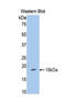 Hexokinase 1 antibody, LS-C297233, Lifespan Biosciences, Western Blot image 