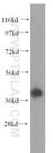 Aldolase, Fructose-Bisphosphate A antibody, 11217-1-AP, Proteintech Group, Western Blot image 