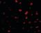 TNF Receptor Superfamily Member 25 antibody, orb88387, Biorbyt, Immunofluorescence image 