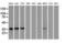 Caudal Type Homeobox 2 antibody, LS-C784143, Lifespan Biosciences, Western Blot image 
