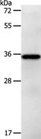 Phospholipid Phosphatase Related 5 antibody, PA5-50564, Invitrogen Antibodies, Western Blot image 