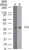 TERF1 Interacting Nuclear Factor 2 antibody, TA336676, Origene, Western Blot image 