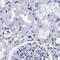 AKAP4 antibody, PA5-52230, Invitrogen Antibodies, Immunohistochemistry frozen image 