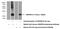 Ankyrin Repeat Domain 39 antibody, 24027-1-AP, Proteintech Group, Western Blot image 