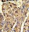 Heterogeneous Nuclear Ribonucleoprotein L antibody, GTX81942, GeneTex, Immunohistochemistry paraffin image 