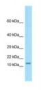 Otospiralin antibody, NBP1-98417, Novus Biologicals, Western Blot image 