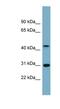 Armadillo Repeat Containing X-Linked 3 antibody, NBP1-62582, Novus Biologicals, Western Blot image 