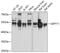 Septin 11 antibody, 14-302, ProSci, Western Blot image 