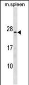 Troponin C2, Fast Skeletal Type antibody, PA5-49222, Invitrogen Antibodies, Western Blot image 