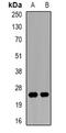 Kallikrein 1 antibody, abx225263, Abbexa, Western Blot image 