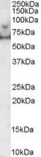 Microtubule Affinity Regulating Kinase 4 antibody, MBS421011, MyBioSource, Western Blot image 