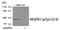Fms Related Tyrosine Kinase 1 antibody, GTX55404, GeneTex, Western Blot image 