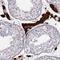 Zinc Finger Protein 433 antibody, PA5-67309, Invitrogen Antibodies, Immunohistochemistry frozen image 