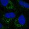 Patatin Like Phospholipase Domain Containing 3 antibody, HPA058058, Atlas Antibodies, Immunocytochemistry image 