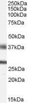 Fibroblast Growth Factor 23 antibody, PA5-18636, Invitrogen Antibodies, Western Blot image 