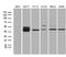 FOS Like 2, AP-1 Transcription Factor Subunit antibody, M02615-1, Boster Biological Technology, Western Blot image 
