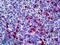 Cathelicidin Antimicrobial Peptide antibody, LS-B6696, Lifespan Biosciences, Immunohistochemistry frozen image 