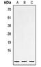 Natriuretic Peptide C antibody, LS-C353760, Lifespan Biosciences, Western Blot image 